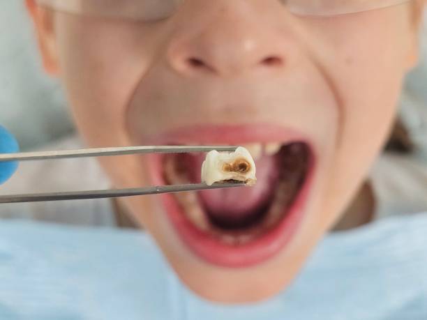 Best Broken Tooth Emergency  in Concordia, KS